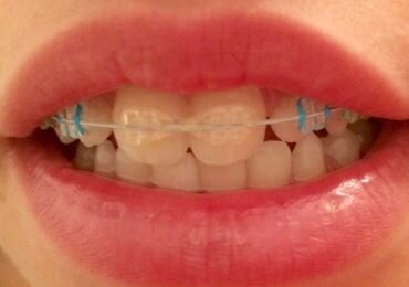 Symetrique Dent - Clinica de stomatologie