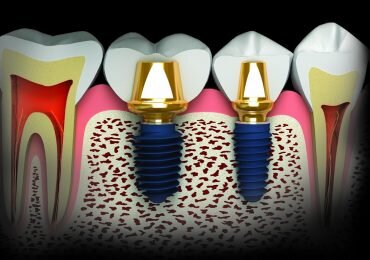Symetrique Dent - Clinica de stomatologie