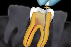 Symetrique Dent - Clinica de stomatologie