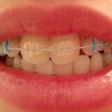 Symetrique Dent - Clinica de stomatologie